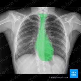 Schritt für Schritt zur Röntgen-Thorax-Befundung | Kenhub