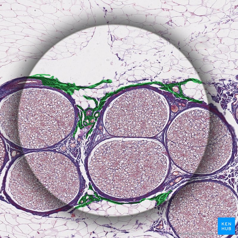 Epineurium - histological slide