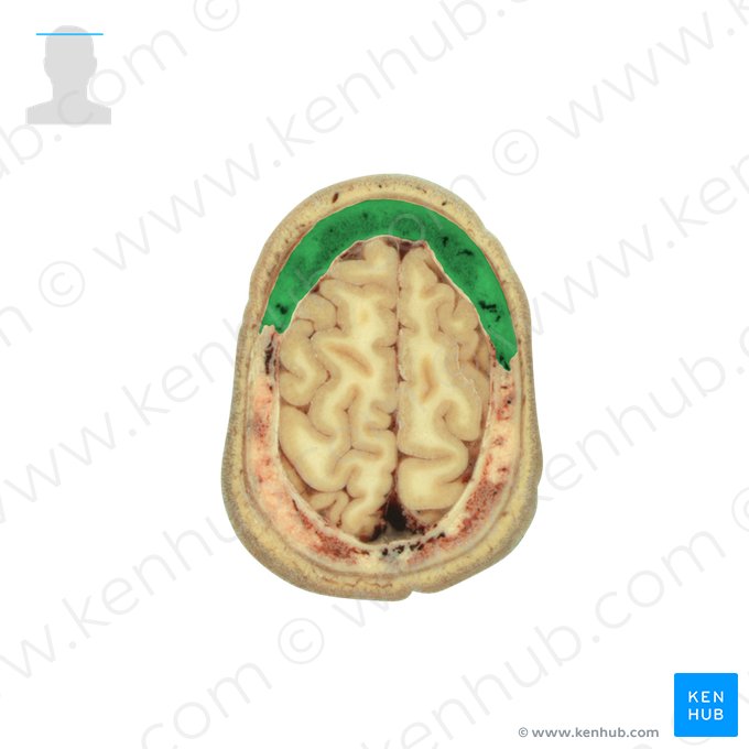 Os frontale (Stirnbein); Bild: National Library of Medicine