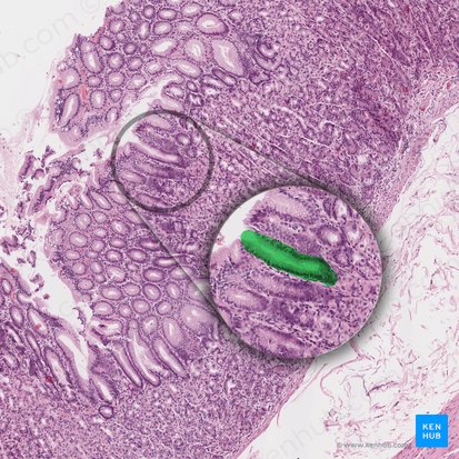 Gastric pit (Foveola gastrica); Image: 