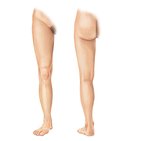 Regions of the lower limb