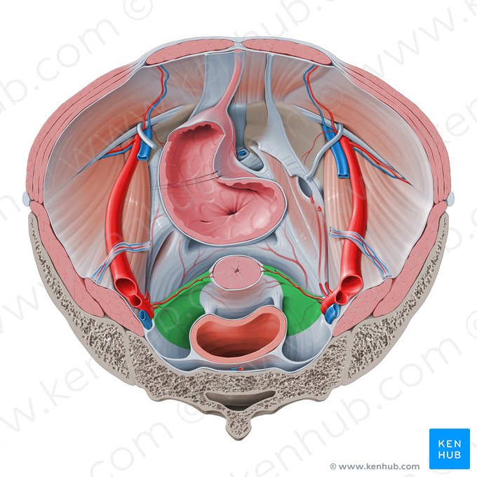 Ligamento cardinal (Ligamentum cardinale); Imagen: Paul Kim