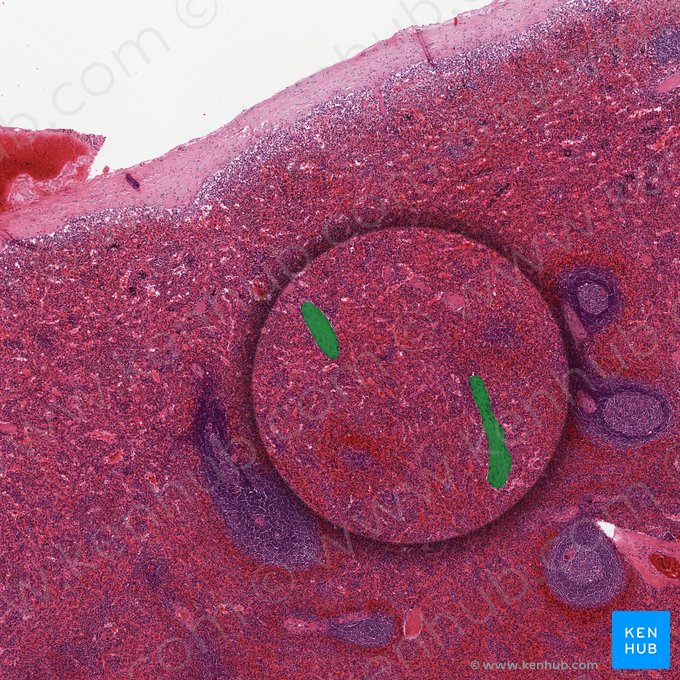 Trabécula (Trabecula); Imagen: 