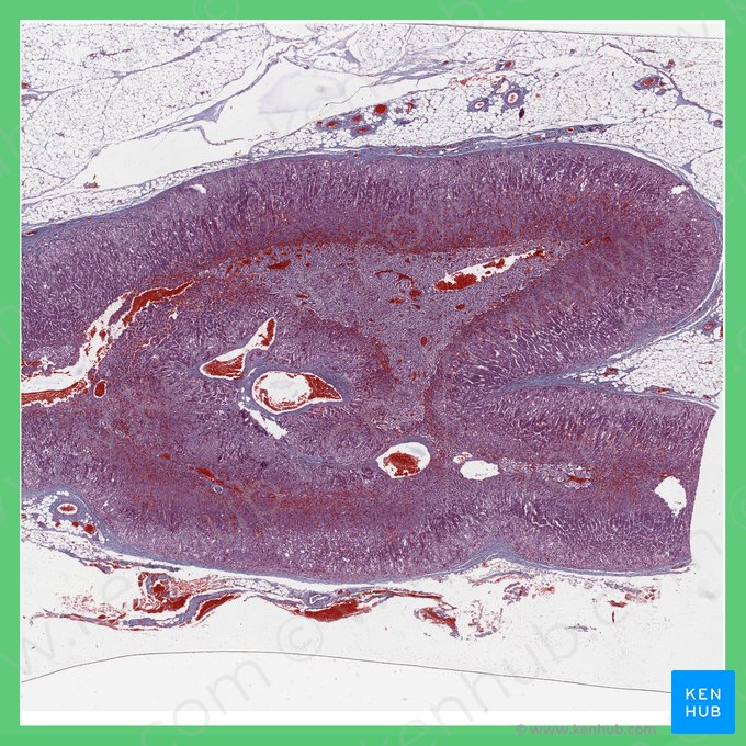 Suprarenal gland (Glandula suprarenalis); Image: 