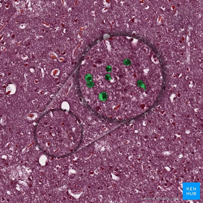 Neurofibrae (Neurone); Bild: 