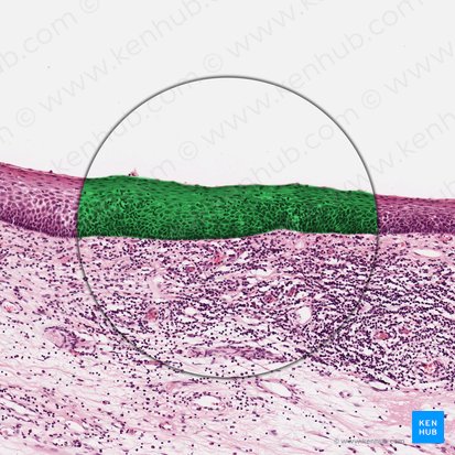 Epithelium stratificatum squamosum non cornificatum (Mehrschichtig unverhorntes Plattenepithel); Bild: 