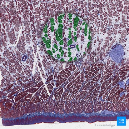 Genioglossus muscle (Musculus genioglossus); Image: 