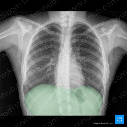 Diaphragme (Diaphragma); Image : 