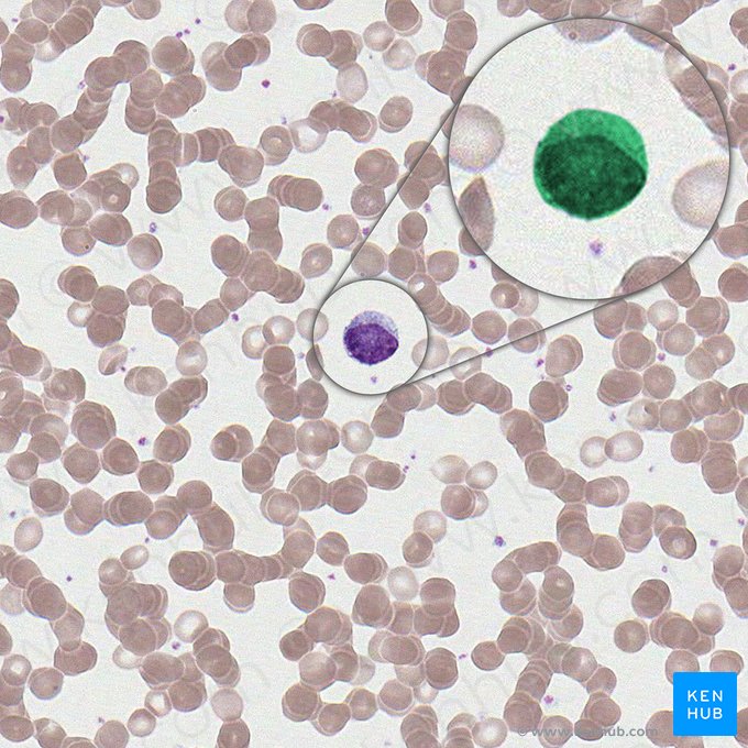 Large lymphocyte (Lymphocytus magnus); Image: 
