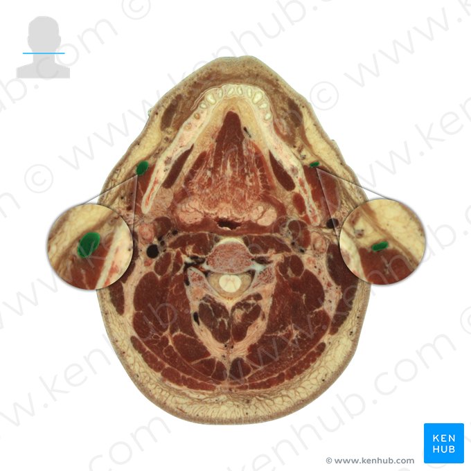 Vena facialis (Gesichtsvene); Bild: National Library of Medicine