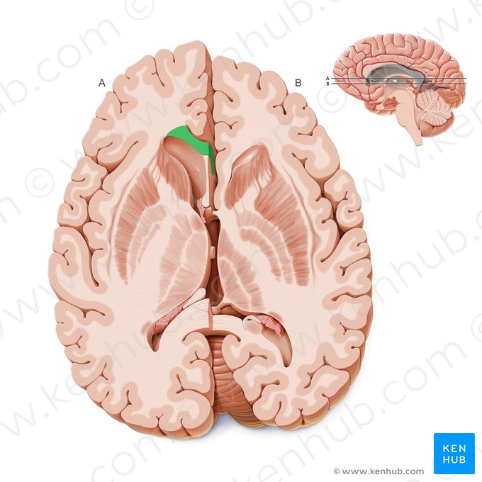 Genu of corpus callosum (Genu corporis callosi); Image: Paul Kim