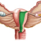 Endométrio