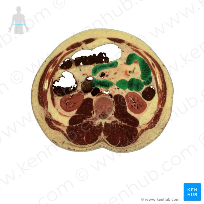 Jejunum (Leerdarm); Bild: National Library of Medicine