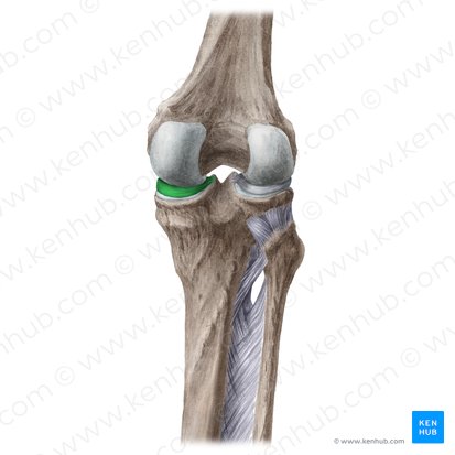 Menisco medial (Meniscus medialis); Imagen: Liene Znotina