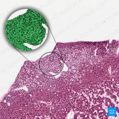 Parathyrocytus endocrinus (Hauptzelle der Nebenschilddrüse); Bild: 