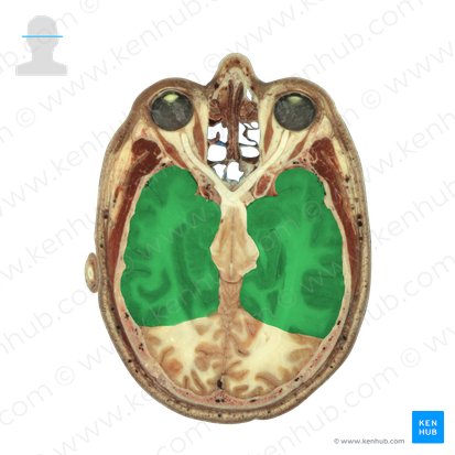 Lobus temporalis (Schläfenlappen); Bild: National Library of Medicine