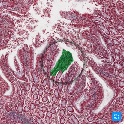 Vellosidad intestinal (Villus intestinalis); Imagen: 