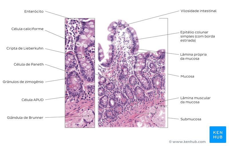 Biópsia do duodeno. Coloração: H+E. Ampliação média 