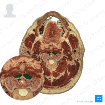 Longus colli muscle (Musculus longus colli); Image: National Library of Medicine