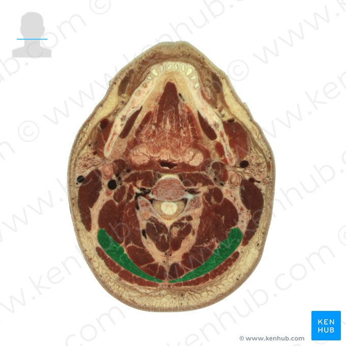 Splenius capitis muscle (Musculus splenius capitis); Image: National Library of Medicine