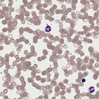 Histología de la sangre