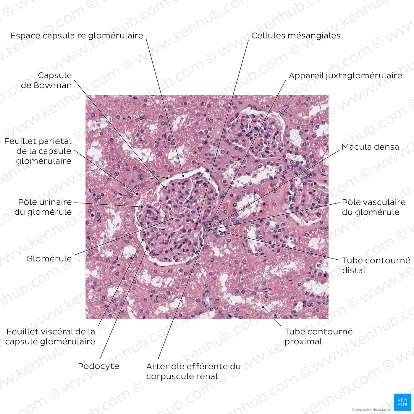 Kidney (renal corpuscle)