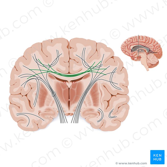 Fibras comisurales (Fibrae commissurales); Imagen: Paul Kim