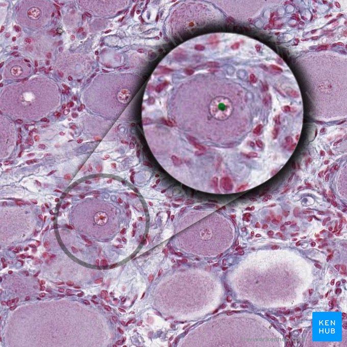Nucleolo de célula ganglionar (Nucleolus neuri ganglionaris); Imagen: 