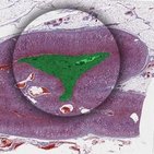 Adrenal medulla