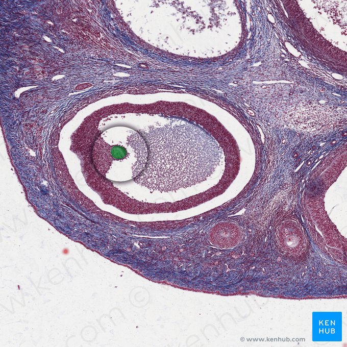 Secondary oocyte; Image: 