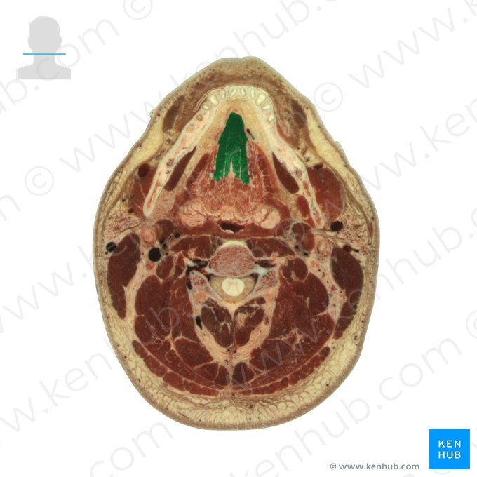 Músculo genioglosso (Musculus genioglossus); Imagem: National Library of Medicine