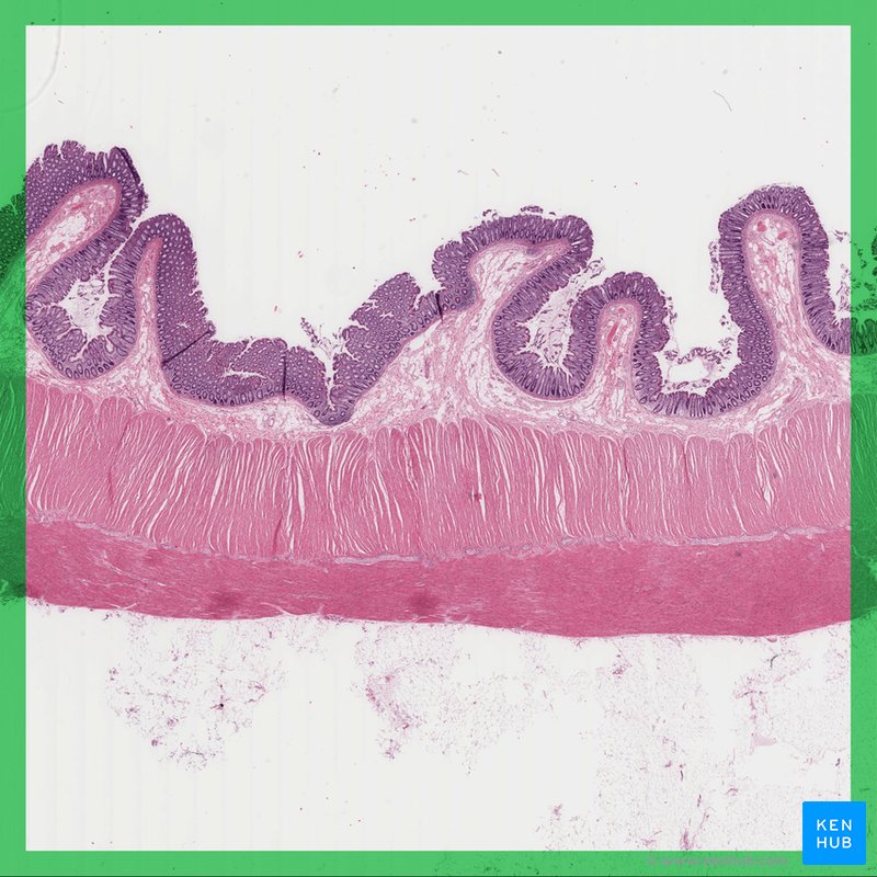 Colon - histological slide