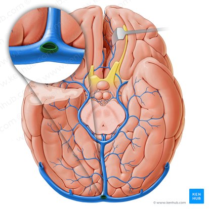 Occipital sinus (Sinus occipitalis); Image: Paul Kim