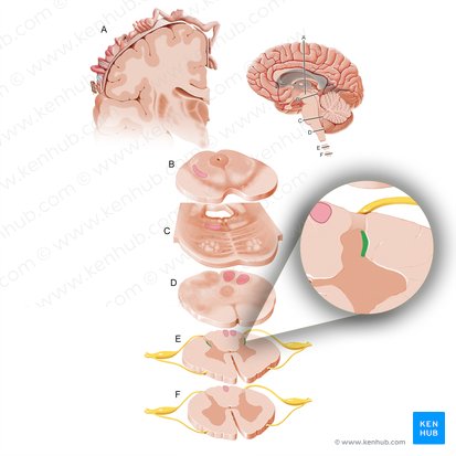 Nucleus cervicalis lateralis (Seitlicher Halskern); Bild: Paul Kim