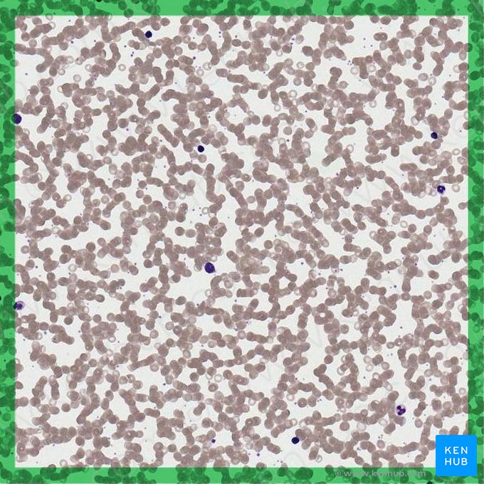 Blood smear (Sanguis); Image: 