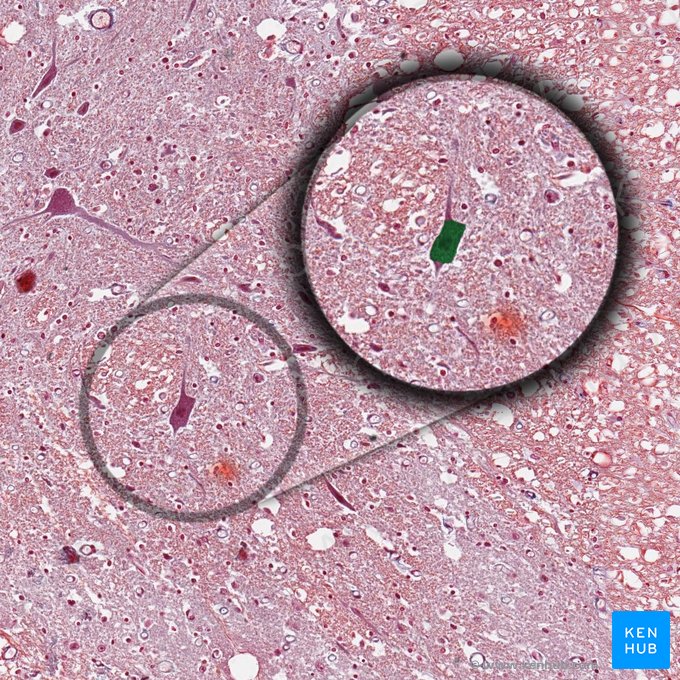 Cuerpo celular de la neurona (Soma); Imagen: 