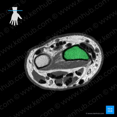 Radius; Image : 