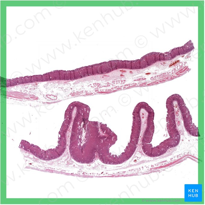 Fundus of stomach (Fundus gastris); Image: 