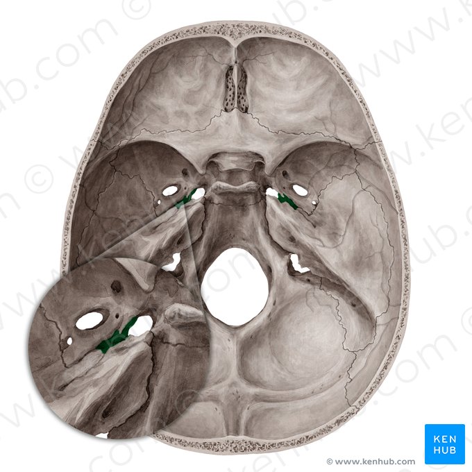 Canal carotídeo (Canalis caroticus); Imagem: Yousun Koh