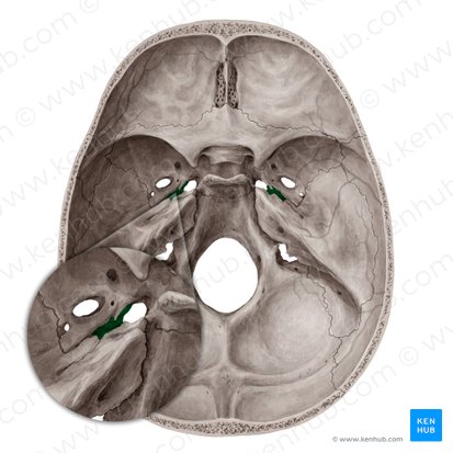 Canal carotídeo (Canalis caroticus); Imagem: Yousun Koh