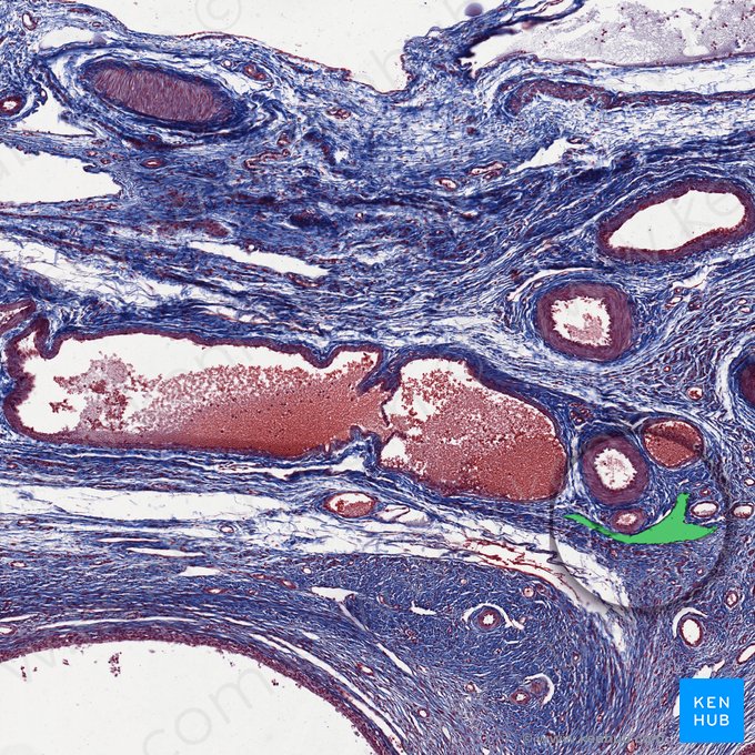 Lymphatic vessel (Vas lymphaticum); Image: 