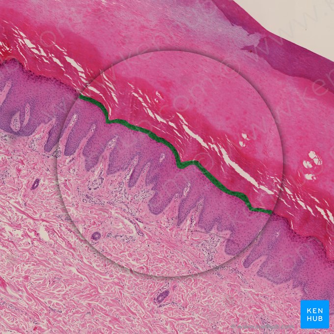 Camada granulosa da epiderme (Stratum granulosum epidermis); Imagem: 