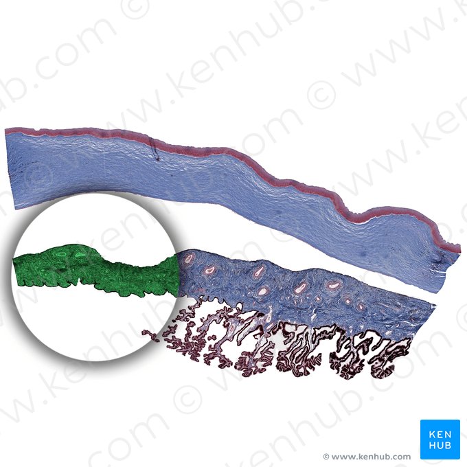 Iris; Image : 