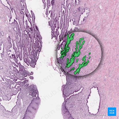 Cervical glands; Image: 