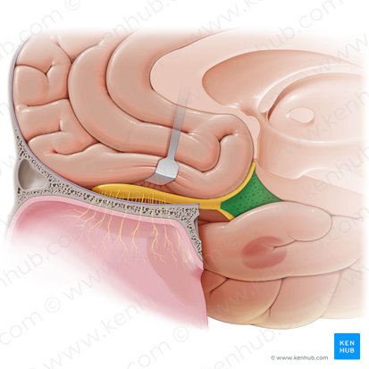 Substantia perforata anterior (Vordere perforierte Substanz); Bild: Paul Kim
