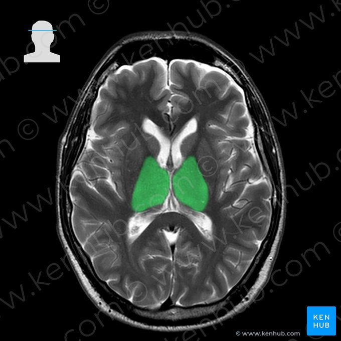 Tálamo (Thalamus); Imagem: 