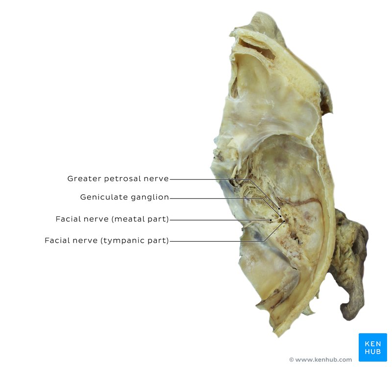 Facial Nerve - Cadaveric Image