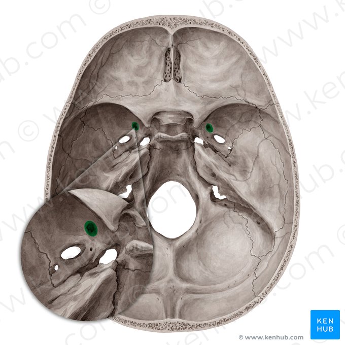 Foramen rotundum; Image: Yousun Koh