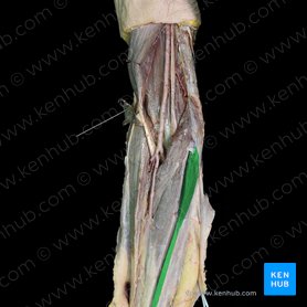 Musculus palmaris longus (Langer Hohlhandmuskel); Bild: 