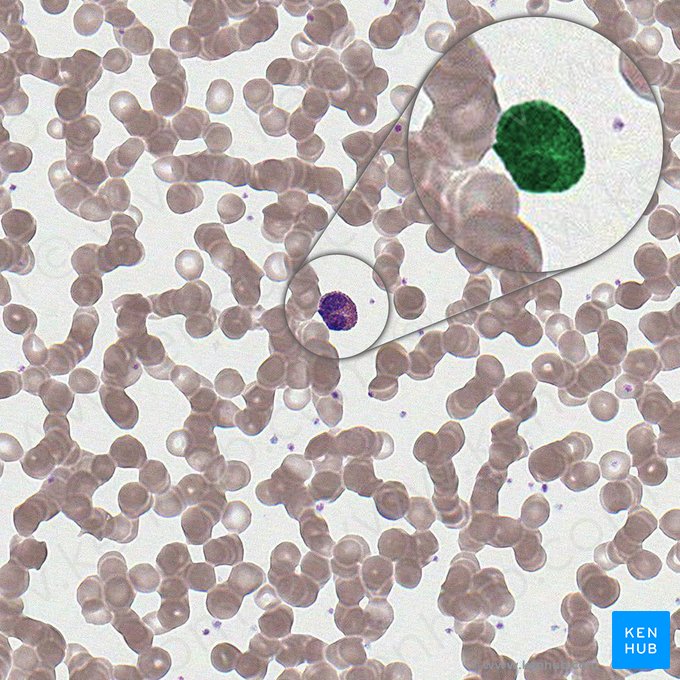 Célula em banda eosinófila (Granulocytus eosinophilus non segmentonuclearis); Imagem: 